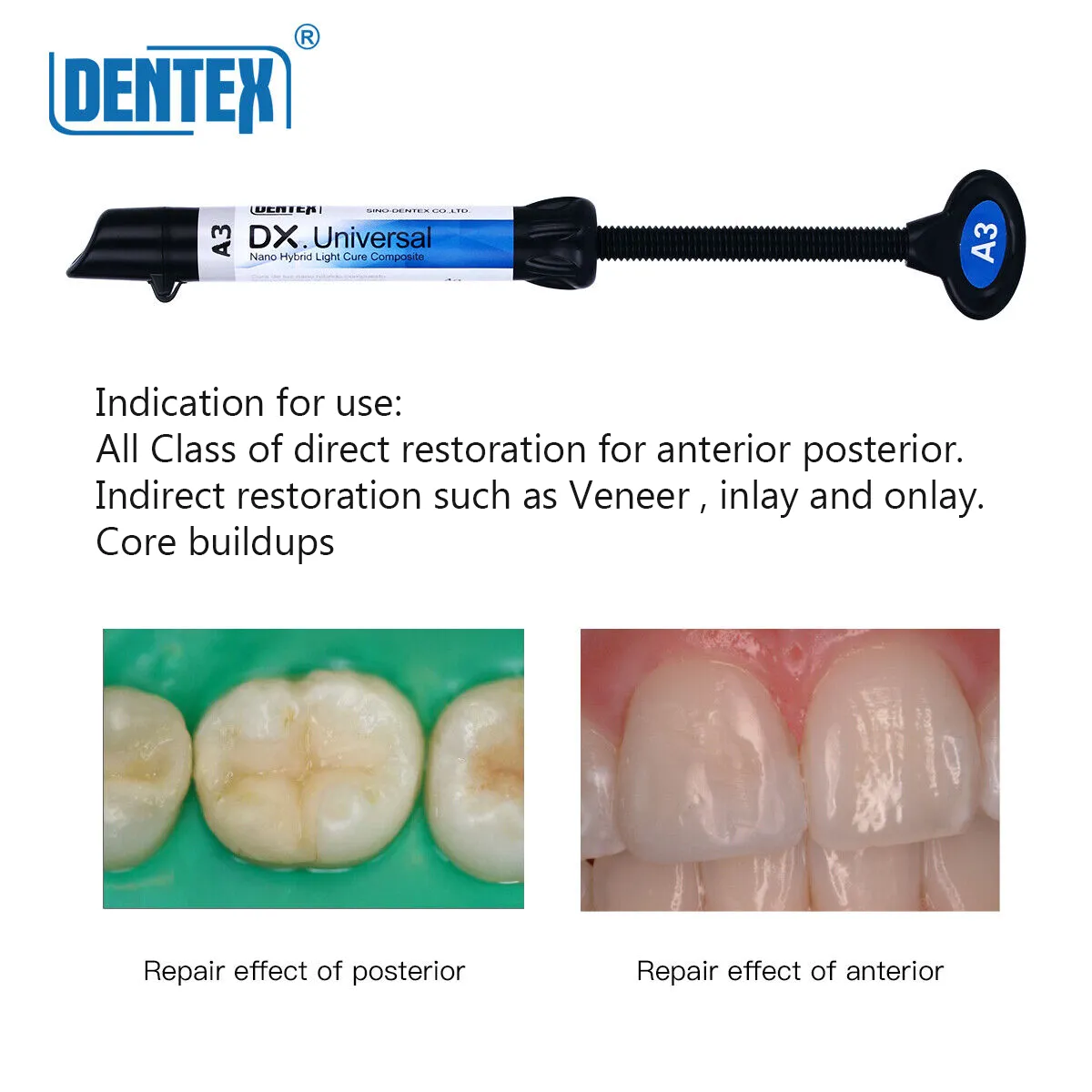 کامپوزیت یونیورسال دنتکس Universal DENTEX - Image 5